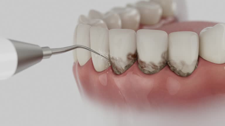 Trusted Root Canal Treatment service in K. I. Sawyer, MI - Dentist Open Now